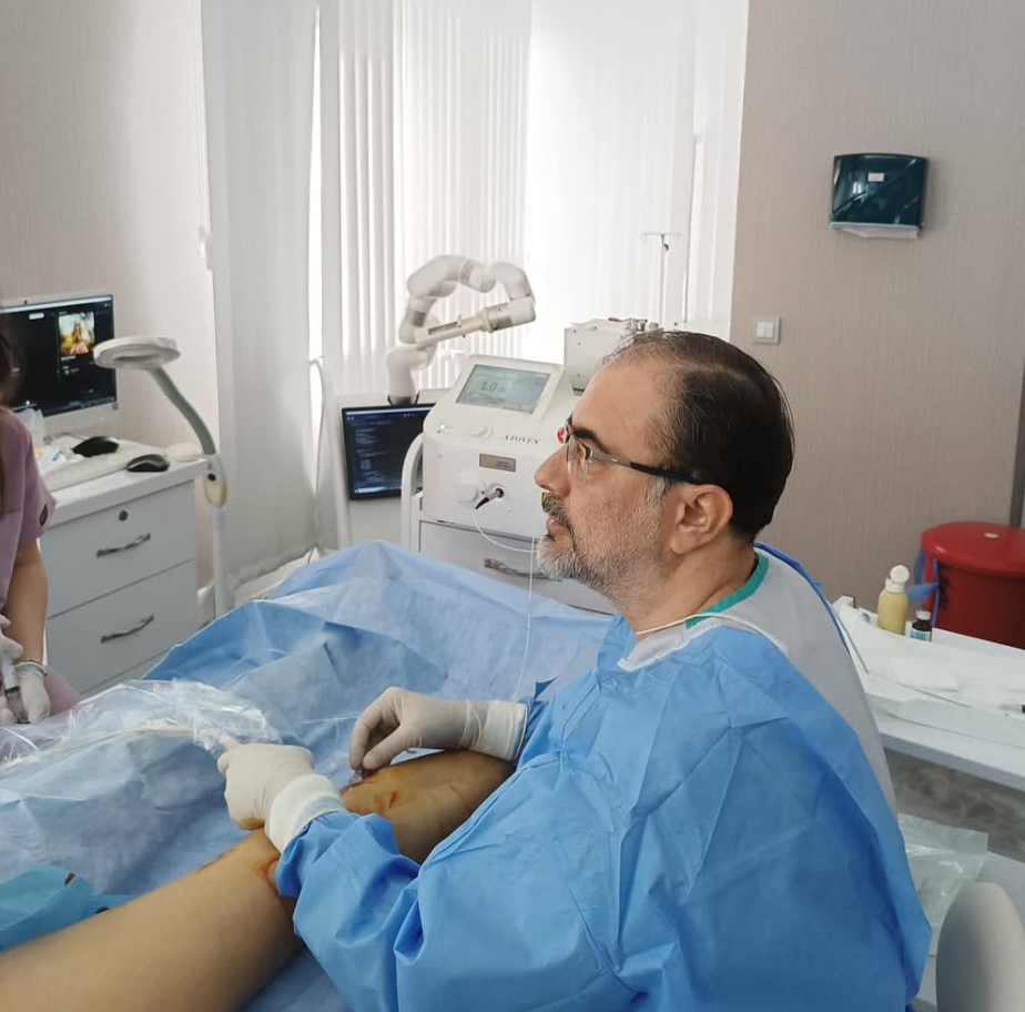 Antalya Lazerle Varis Tedavisi