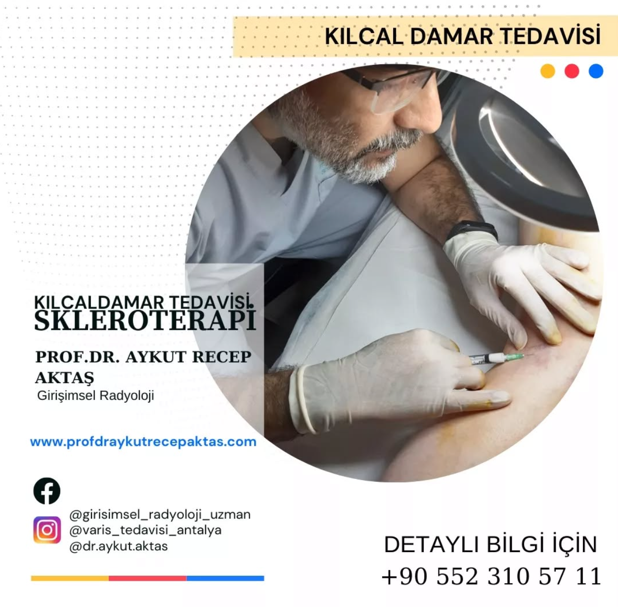 Antalya Kılcal Damar Tedavisi